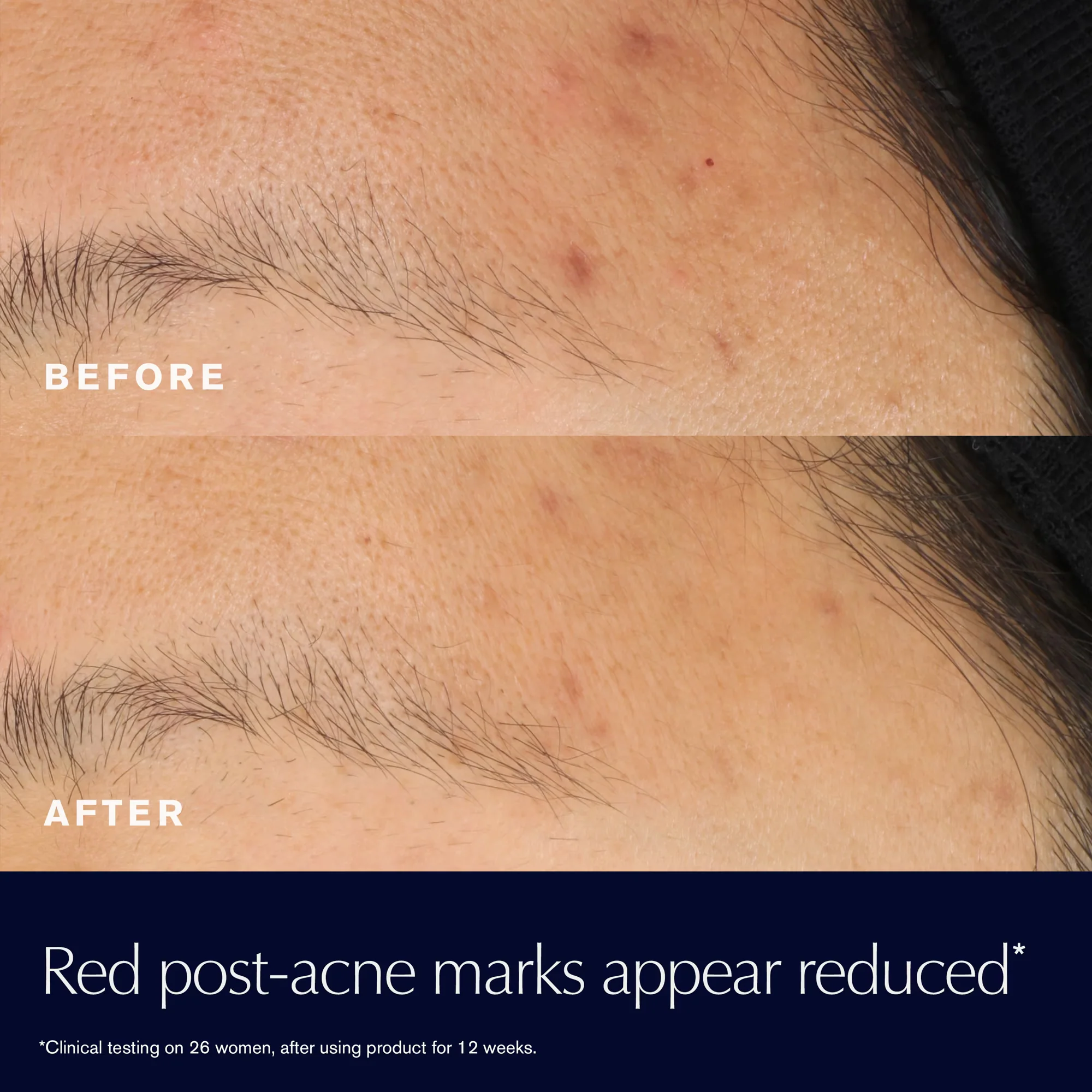 Estée Lauder Advanced Night Repair Rescue Solution Serum With 15% Bifidus Ferment - 0.7 oz. - Image 4