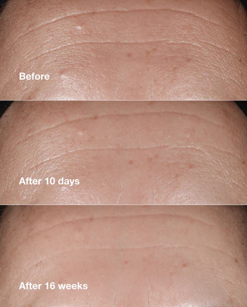 Clinique Smart Clinical Repair Wrinkle Correcting Serum - 1 oz. - Image 7